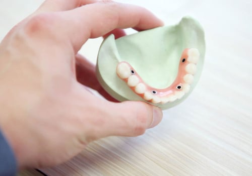 Real-life Examples of Improved Quality of Life with Implant-Supported Dentures