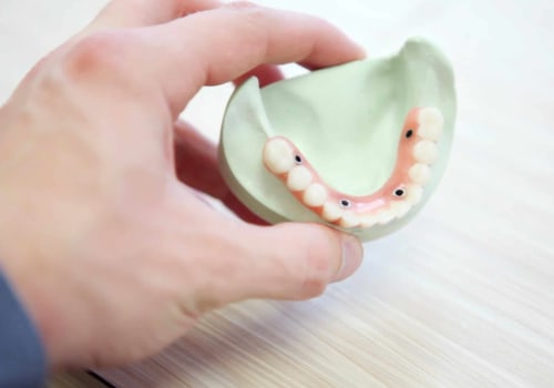How to Replace Missing Teeth with Partial Dentures